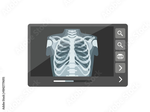 Radiology Scan of a Chest X-Ray Examination and Medical Analysis