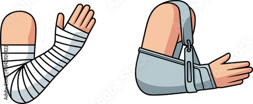 Injured arm illustration showing wrapped bandage and arm sling support, representing medical care, fractures, sprains, rehabilitation, first aid treatment, and orthopedic recovery concepts.