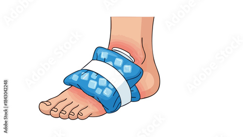 Injured foot with ice pack wrapped around ankle for medical treatment  