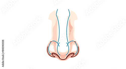 Surgical diagram illustrating the airflow changes and structural alterations made to the nose during a rhinoplasty or nose job procedure.