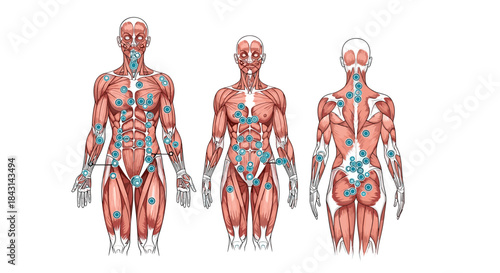 Anatomical charts of the human muscular system from anterior, posterior, and lateral views, showing common trigger points for pain.