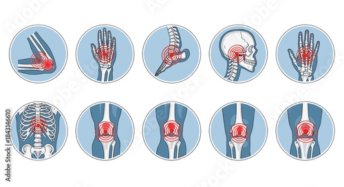 A set of medical icons showing various points of pain in the human skeleton, including knee, back, wrist, and head.