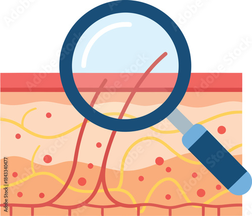 Skin Analysis Dermatology Magnifier Vector