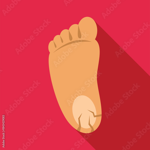 Human foot illustrating a cracked heel condition with dry skin