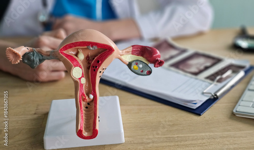 Doctor with Uterus and Ovaries anatomy model. Ovarian and Cervical cancer, Cervix disorder