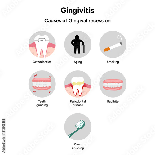 Hand-drawn dental infographic gingivitis and causes of gingival recession. Educational illustration explaining gum inflammation, receding gums, and periodontal problems