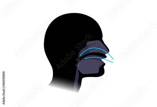 Obstructive sleep apnea