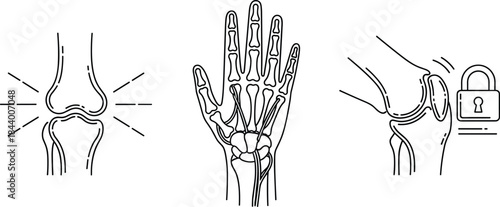 Set of joint and bone illustrations showing knee pain, hand skeleton anatomy, and locked joint concept for medical, orthopedic, and health education graphics