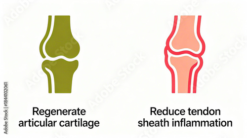 Reducing tenosynovitis with articular cartilage represents the protective function of regenerating articular cartilage and alleviating tenosynovitis, suitable for health care materials.
