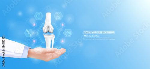 Total knee replacement model in doctor hand. leg joint bone surrounded by medical icons. Technologies in science health care. Realistic 3D Vector.