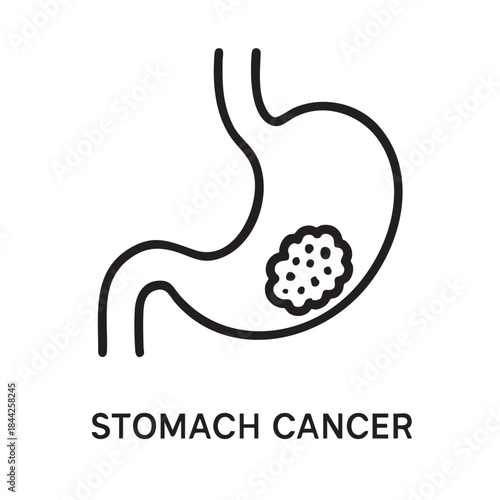 A simple line drawing depicting a human stomach with a noticeable growth or tumor labeled stomach cancer