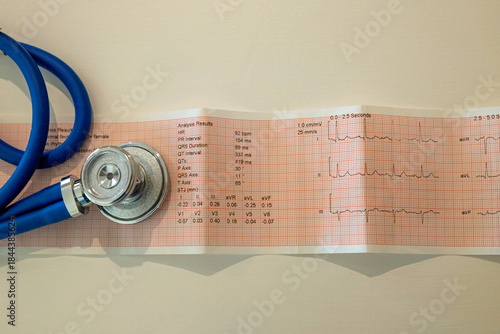 Echo cardiogram, heart, health. ECG test results, information for doctor, physician regarding clinic treatment. PQRST sinus rhythm Editorial medical heart related picture. EKG cardiac trace.