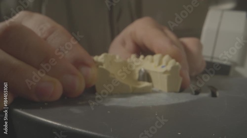 Closeup dental cast inspection on workbench with technician hands, gypsum model pin and abutment visible, careful trimming