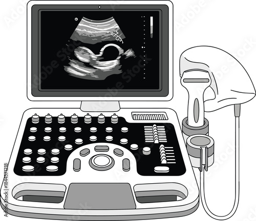 Ultrasound machine with fetal image, medical diagnostic equipment, prenatal care technology, sonography monitor, healthcare device, black and white hospital scene