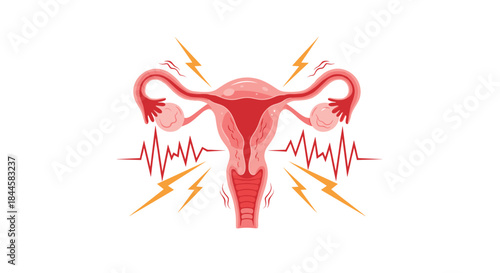 Medical illustration of a female uterus with ovaries experiencing pain, cramps, and spasms, symbolizing menstrual or reproductive issues.