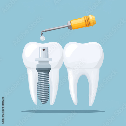 Dental implant with tooth and medical tool illustration