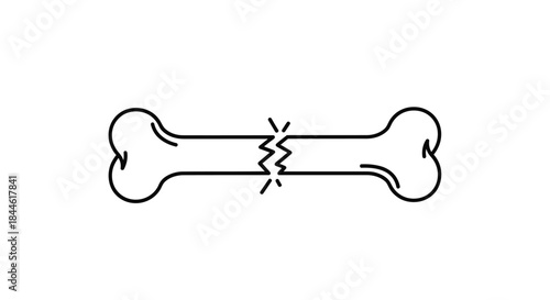 Simple black and white illustration depicting a fractured bone with jagged edges