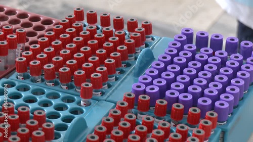 Workbench with tray with blood tests for examine in the hematology laboratory. Workplace Rack with tubes of blood samples from patients in the Clinical Analysis laboratory of the hospital