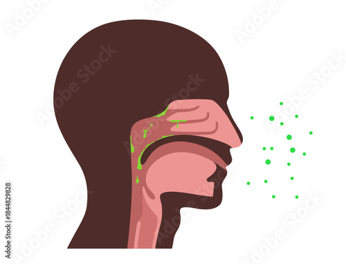 Postnasal drip poster