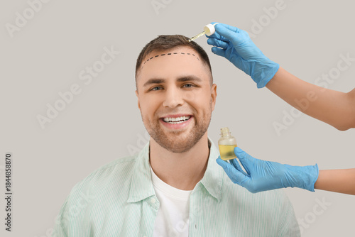 Young man with hair loss pr...