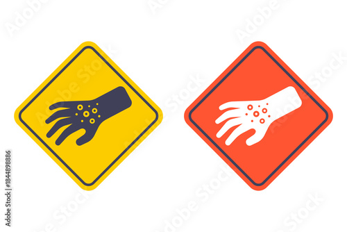 Red rash on hand icon. Flat illustration.