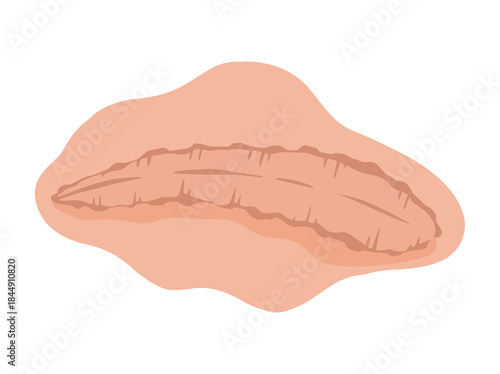 Scar Skin Repaired Tissue Illustration