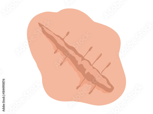 Scar Repaired Tissue