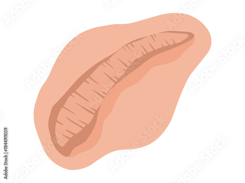 Scar Tissue Repair Clip Art