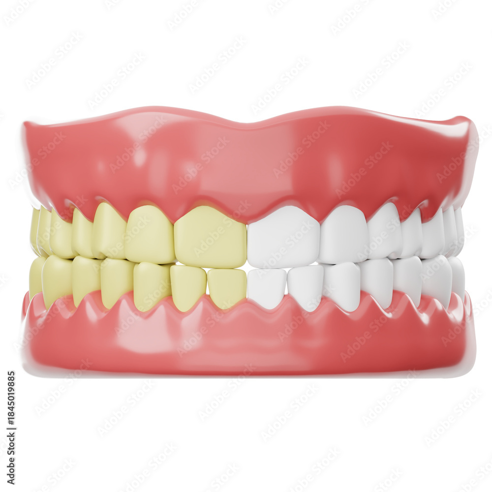 Obraz premium Dental Model Showing Teeth Whitening Process