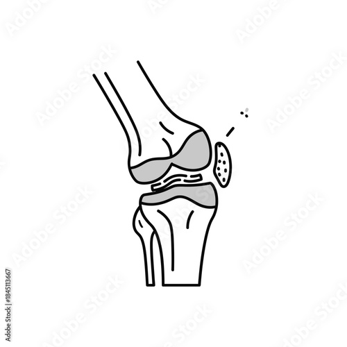 Conceptual Knee Joint Illustration Vector Clipart Anatomy Bacterium Infection Medical Diagram