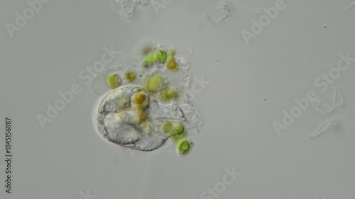 Ein Einzeller frisst einen anderen Einzeller durch Phagocytose, Mikroskopfilm