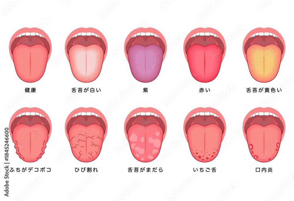 Fototapeta premium 舌でわかる健康状態 舌診 舌の健康
