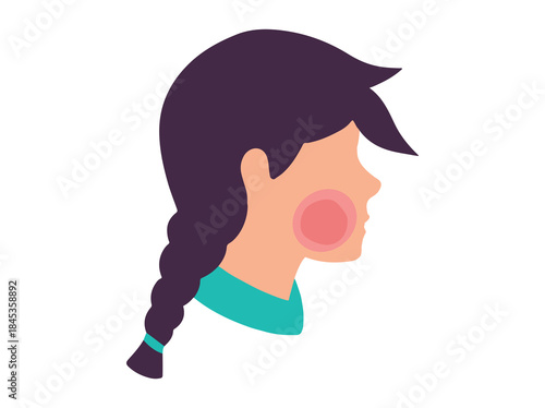 Fifth Disease Erythema Infectiosum Illustration

