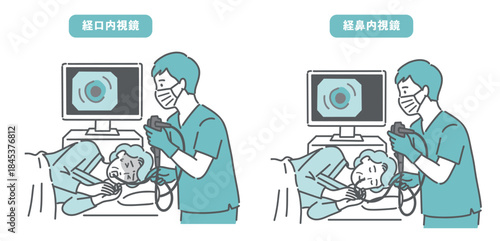 高齢女性の経口内視鏡と経鼻内視鏡の比較イラスト（苦痛と安楽の違い）