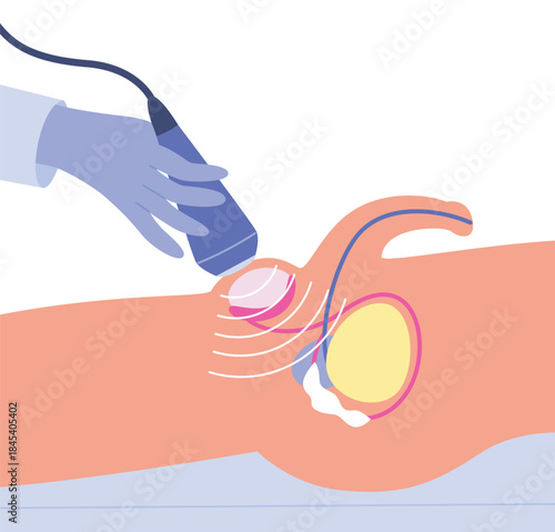 Testicular ultrasound. Male reproductive system diagnostic. Flat vector illustration of medical diagnostic procedure