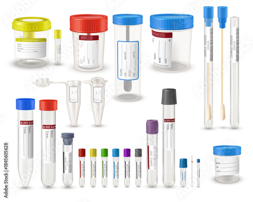 A set of containers for urine, feces, blood analysis, different shapes, with colored lids, labels.