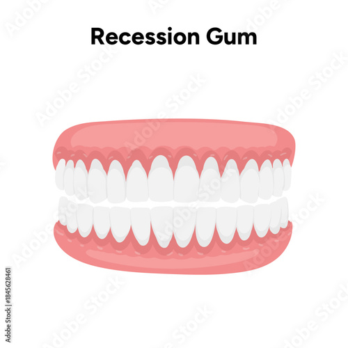 Hand-drawn dental illustration showing gum recession. Educational visual explaining receding gums and oral health problems