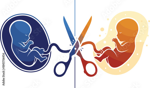 Concept illustration of twin fetuses separated by cutting umbilical cord, life choice symbolism, medical ethics, pregnancy decision, separation concept, prenatal devel
