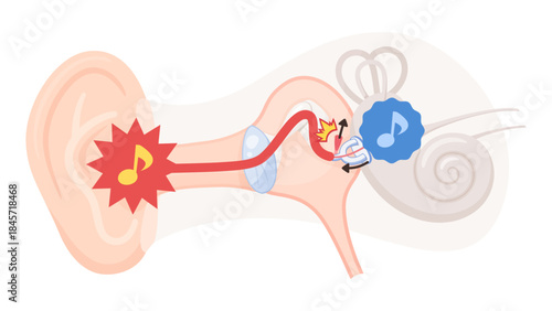 アブミ骨筋反射のイラスト素材