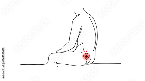 Minimalist Line Art of Hemorrhoids or Anal Discomfort and Rectal Swelling, Proctology Illustration for Gastrointestinal Pain, Perianal Pain, and Colon Health Concept Awareness