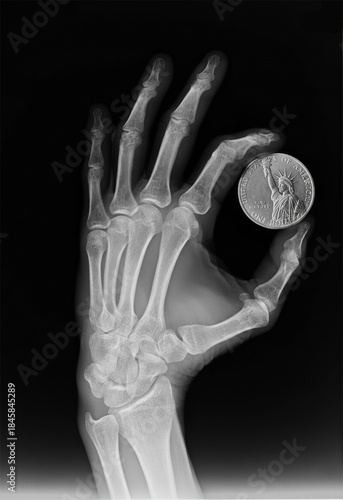 X-ray of a skeletal hand with a dollar coin between its fingers. Symbol of extreme usury and avarice. Image generated using AI