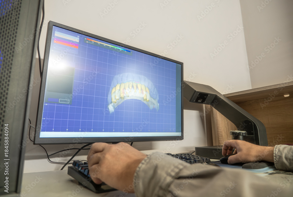 Fototapeta premium Digital dental design 3D modeling of teeth using CAD CAM software for creating metal-ceramic dental crowns, prosthodontics, computer-aided design.