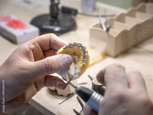 Bilde på lerret Detailed backside view of metal-ceramic dental crowns being processed on model in lab, showing prosthodontic work and preparation before ceramic layering