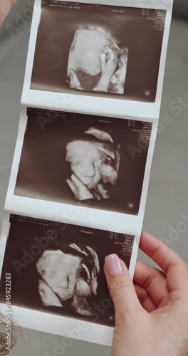 Woman holding three 3D ultrasound images showing developing fetus with detailed facial features and hands