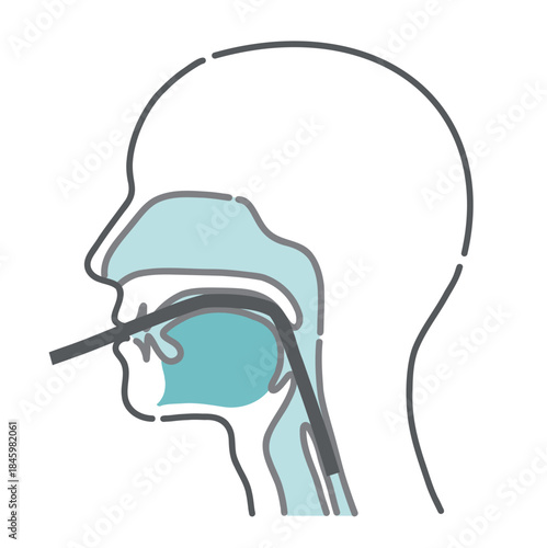 経口内視鏡の挿入ルート図（口からの胃カメラ・断面図）