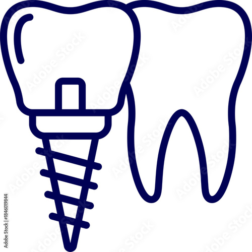 Vector of implant. Black line icon for implant braces. Dental implant icon, a tooth crown on a screw isolated on white background, representing modern dentistry and oral care, vector illustration. 