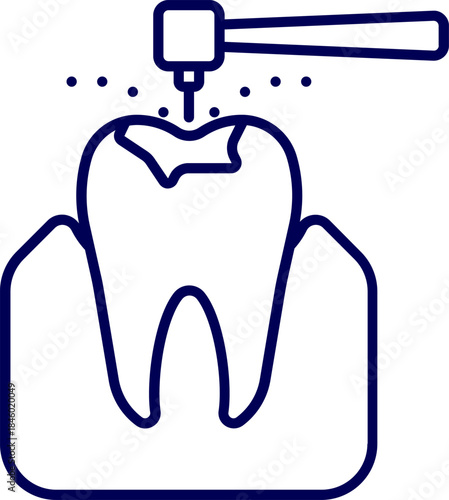 Vector of dental Filling. Dental treatment icon with tooth and drill. Concept of dentistry, caries removal, filling, and oral hygiene. 