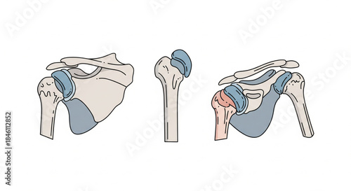 Detailed medical illustration of the human shoulder joint, presenting various anatomical views of the scapula, clavicle, humerus, and surrounding connective tissues