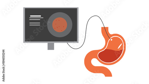 A medical illustration shows a stomach connected to a computer monitor displaying internal data, representing medical diagnostics and technology.