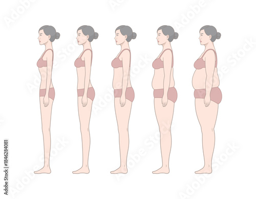 Female Body Weight Change Side View Illustration Showing Underweight to Obesity Stages, Standing Woman Profile Anatomy and BMI Health Comparison